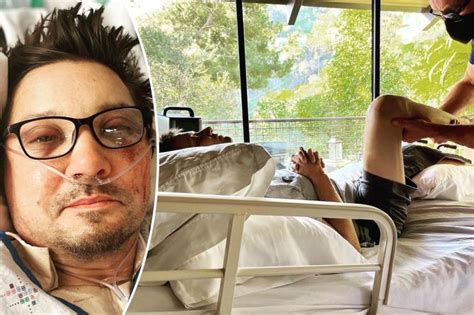 did jeremy renner lose his leg|Jeremy Renner’s Full Injury List After Traumatic Snowplow。